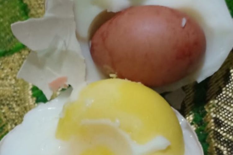 Download Sistem Organ Tubuh Yang Berfungsi Mengolah Makanan Dalam Tubuh Adalah&nbsp;PNG